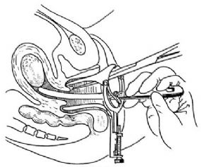 1470727164798669.png blob.png