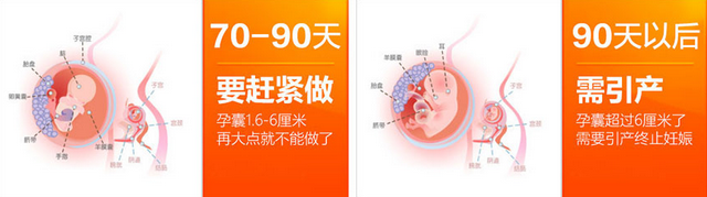 1470814437930734.png blob.png